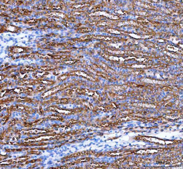  IHC analysis of PARD6B using anti-PARD6B antibody (A08475-2)