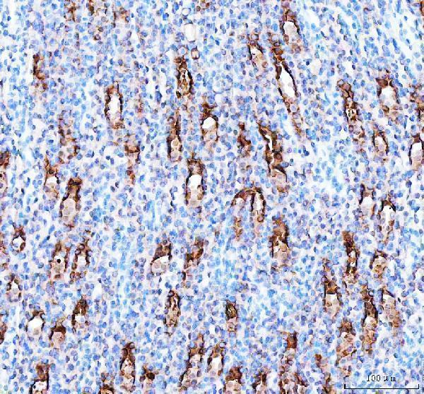 a08475 2 pard6b primary antibodies ihc testing 3