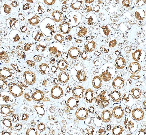 IHC analysis of PARD6B using anti-PARD6B antibody (A08475-2)