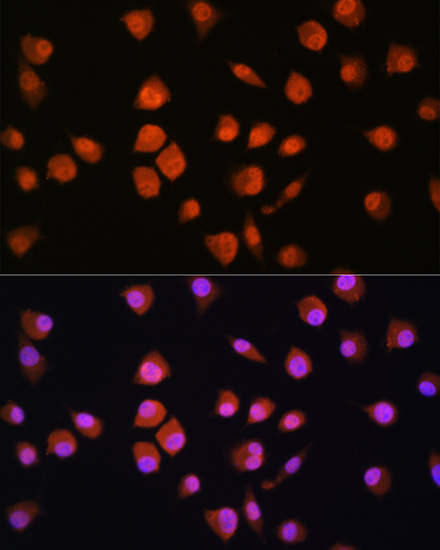Immunofluorescence analysis of L929 cells using NPLOC4 Rabbit pAb  at dilution of 1:100