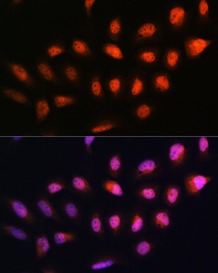 Immunofluorescence analysis of U2OS cells using NPLOC4 Rabbit pAb  at dilution of 1:100