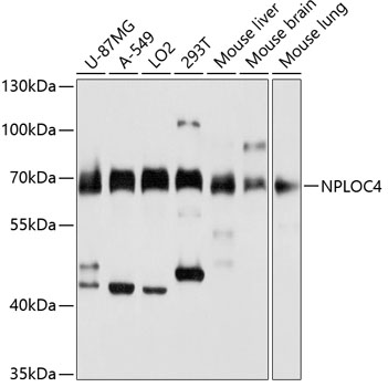 Western blot analysis of extracts of various cell lines, using NPLOC4 antibody  at 1:3000 dilution