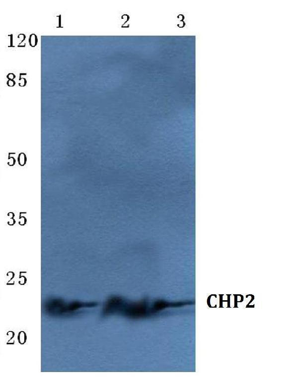 Western blot (WB) analysis of CHP2 polyclonal antibody at 1:500 dilution
Lane1:HepG2 cell lysate
Lane2:Mouse liver tissue lysate
Lane3:H9C2 cell lysate
