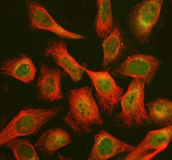  IF analysis of CHP2 using anti-CHP2 antibody (A08478-2) and anti-Beta Tubulin antibody (M01857-3)