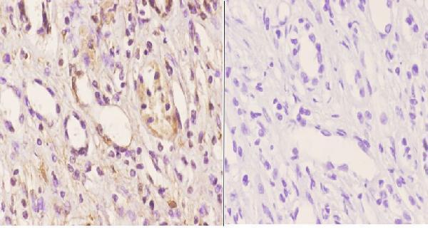 a08479 abcd4 primary antiboties ihc testing 2