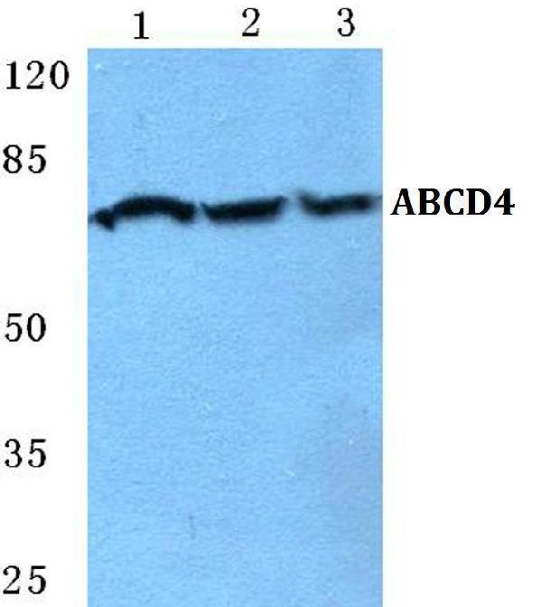 a08479 abcd4 primary antiboties wb testing 1