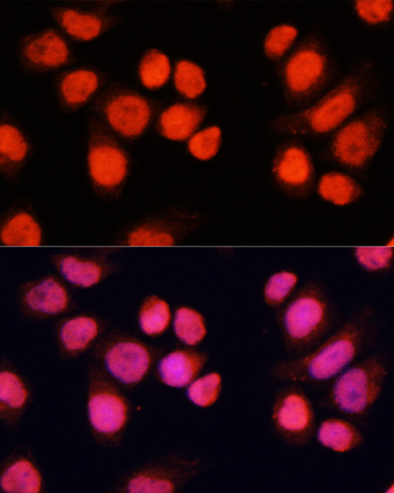 Immunofluorescence analysis of Hela cells using CHAMP1 antibody  at dilution of 1:100 