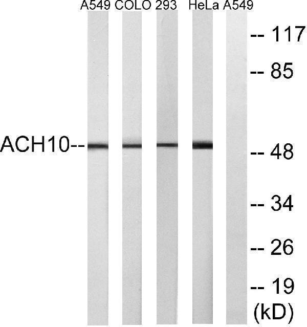 a08482 chrna10 primary antibodies wb testing 1