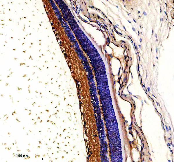 IHC analysis of GCAP2/GUCA1B using anti-GCAP2/GUCA1B antibody (A08484-1)