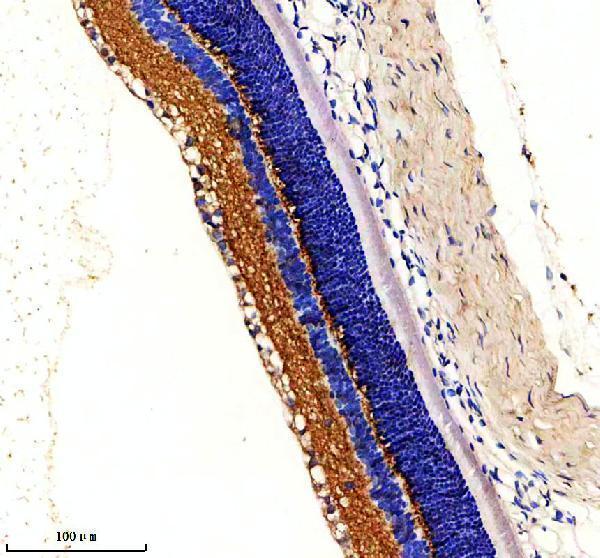 IHC analysis of GCAP2/GUCA1B using anti-GCAP2/GUCA1B antibody (A08484-1)