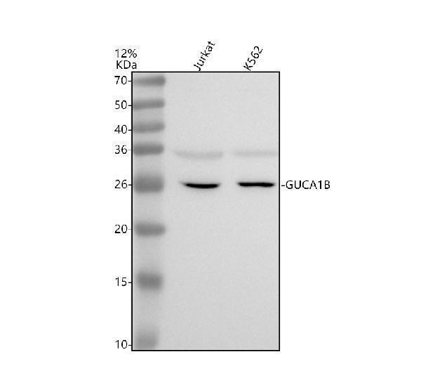 Western blot analysis of GCAP2/GUCA1B using anti-GCAP2/GUCA1B antibody (A08484-1)
