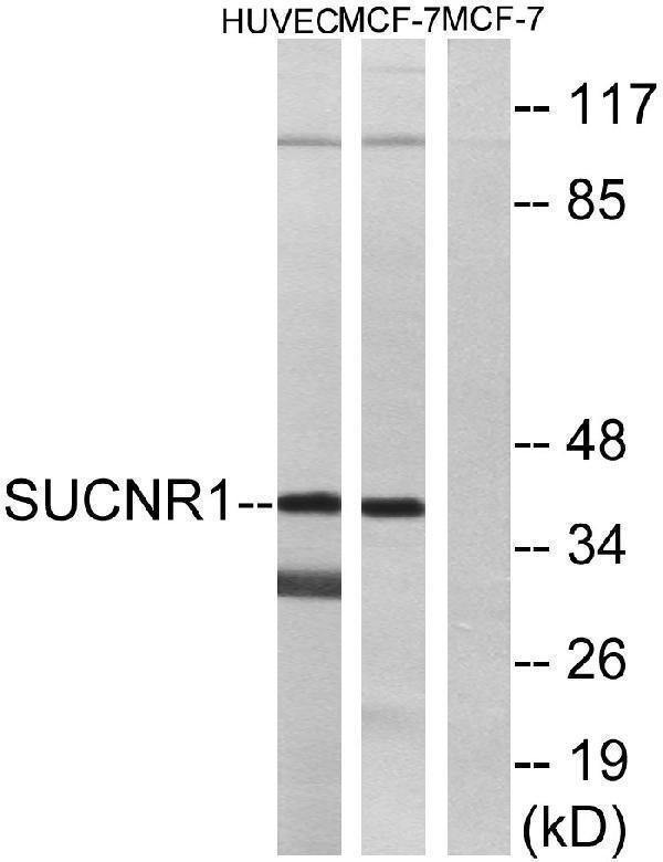 a08485 sucnr1 primary antibodies wb testing 1