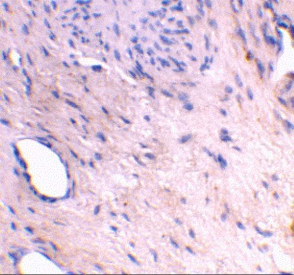 a08487 arl6ip1 primary antibodies ihc testing 2