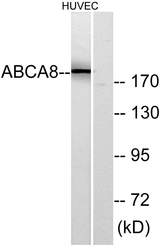 Western blot analysis of lysates from HUVEC cells, using ABCA8 Antibody