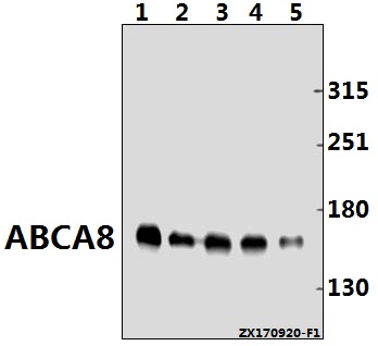 Western blot (WB) analysis of ABCA8 (F1195) pAb at 1:500 dilution
Lane1:H9C2 whole cell lysate(40ug)
Lane2:AML-12 whole cell lysate(40ug)
Lane3:SK-OVCAR3 whole cell lysate(40ug)
Lane4:HepG2 whole cell lysate(40ug)
Lane5:L02 whole cell lysate(10ug)