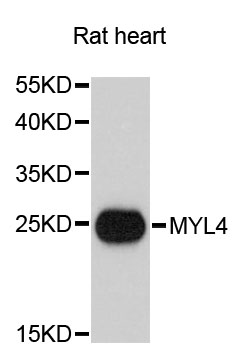 Western blot analysis of extracts of rat heart, using MYL4 antibody at 1:3000 dilution