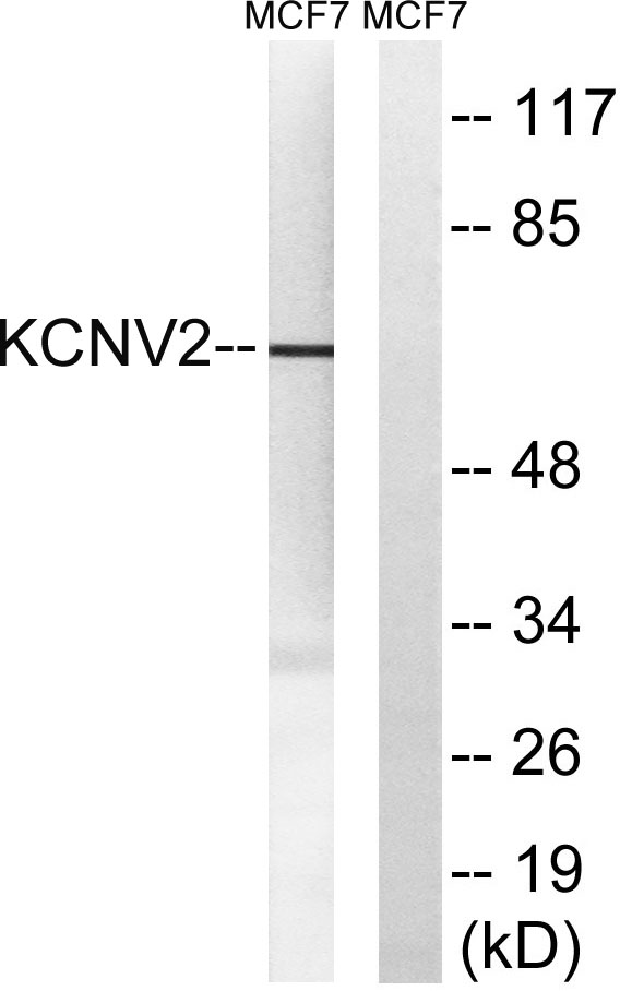 a08497 kcnv2 primary antibodies wb testing 3