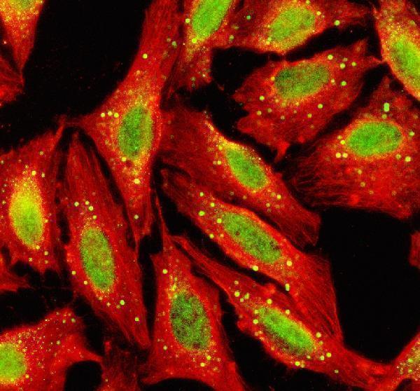 IF analysis of TGIF2 using anti-TGIF2 antibody (A08499-2) and anti-Beta Tubulin antibody (M01857-3)