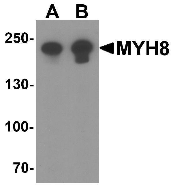 a08502 myh8 primary antibodies wb testing 1