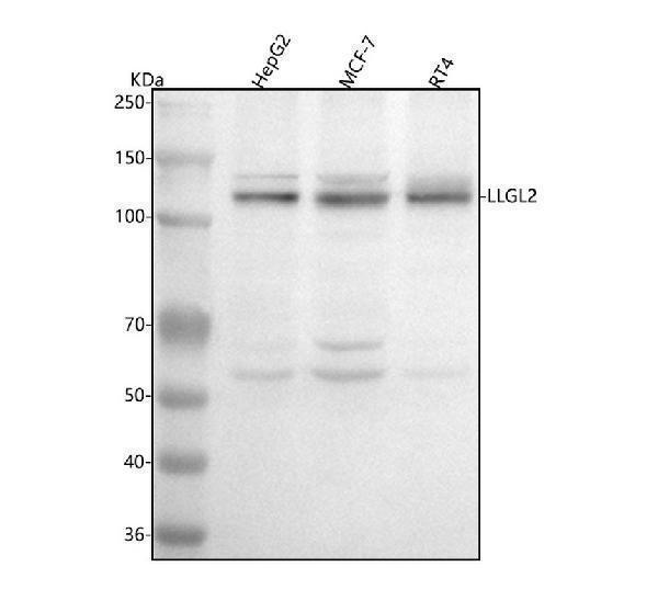  Western blot analysis of LLGL2 using anti-LLGL2 antibody (A08503-1)
