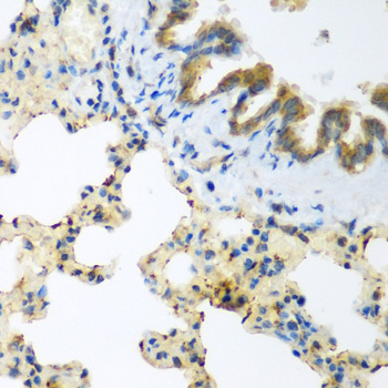 a08503 llgl2 primary antiboties if testing 2