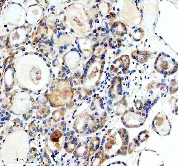 a08504 laptm4b primary antibodies ihc testing 1