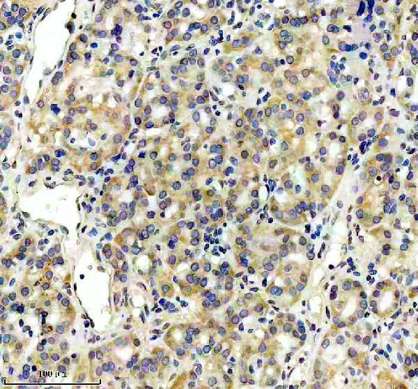 a08504 laptm4b primary antibodies ihc testing 2