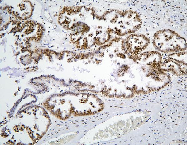 a08507 1 phf21a primary antibodies ihc testing 10_1