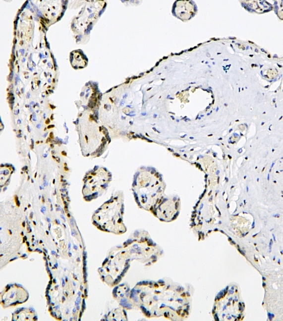 a08507 1 phf21a primary antibodies ihc testing 11_1