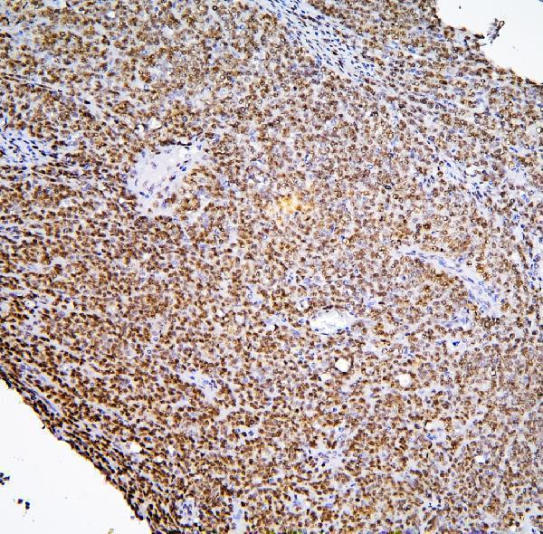 a08507 1 phf21a primary antibodies ihc testing 12_1