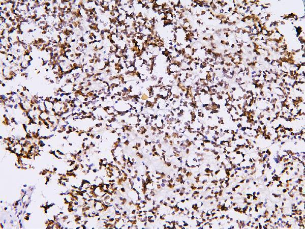 a08507 1 phf21a primary antibodies ihc testing 13_1