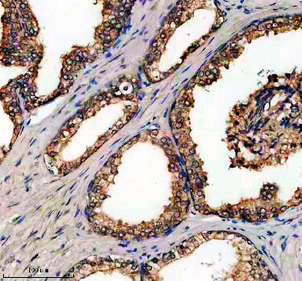 IHC analysis of DNASE2 using anti-DNASE2 antibody (A08512-1)