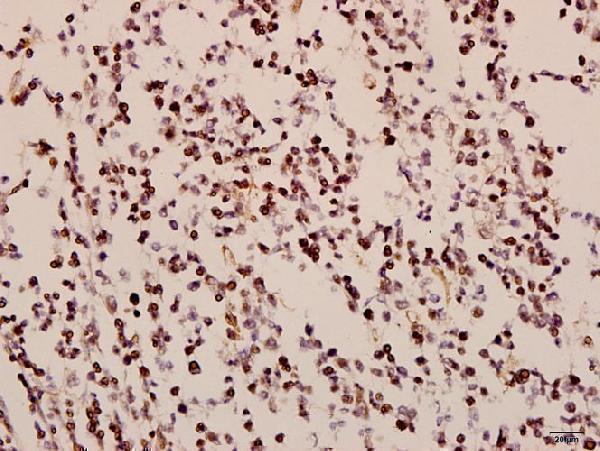 a08513 1 gnaz primary antiboties ihc testing 2