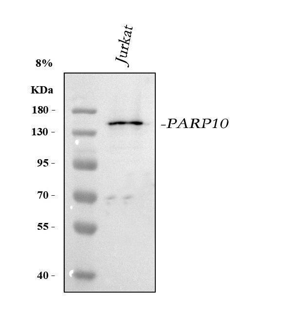  Western blot analysis of PARP10 using anti-PARP10 antibody (A08514-2)
