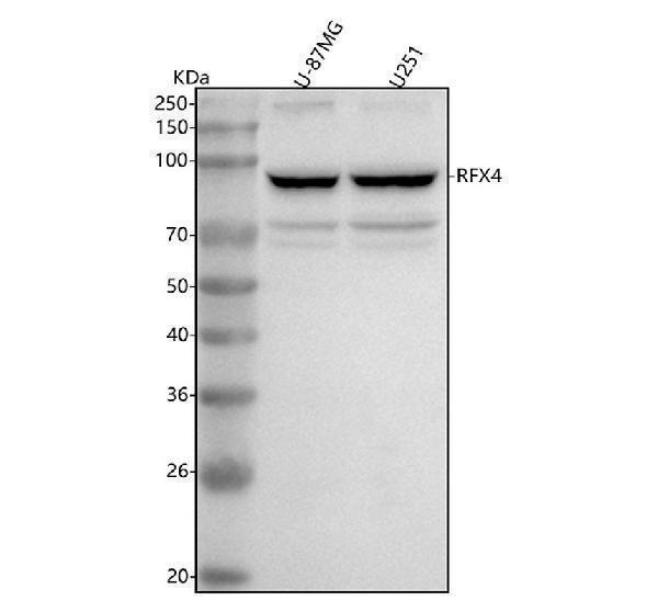  Western blot analysis of RFX4 using anti-RFX4 antibody (A08516-2)
