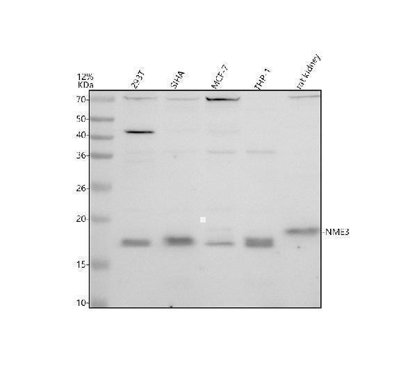 Western blot analysis of NME3 using anti-NME3 antibody (A08517-1)