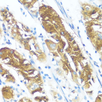 Immunohistochemistry of paraffin-embedded human stomach using NME3 antibody  at dilution of 1:100 