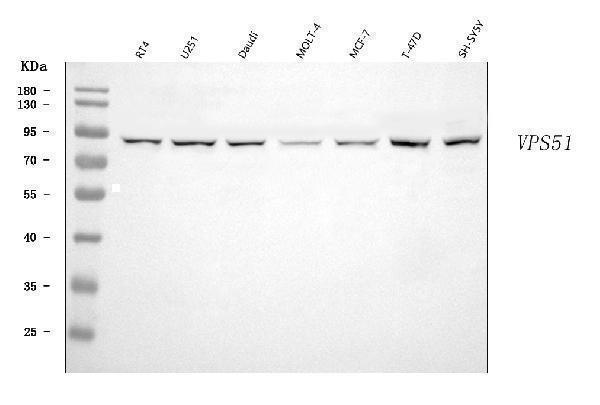  Western blot analysis of FFR/VPS51 using anti-FFR/VPS51 antibody (A08518-1)