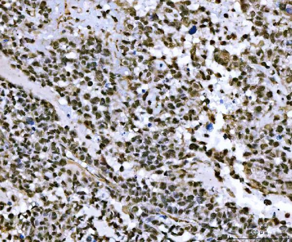  IHC analysis of THAP11 using anti-THAP11 antibody (A08519-2)
