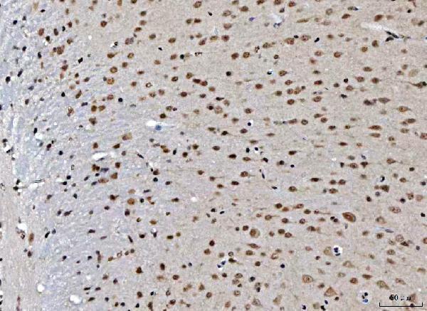 a08519 2 thap11 primary antibodies ihc testing 5