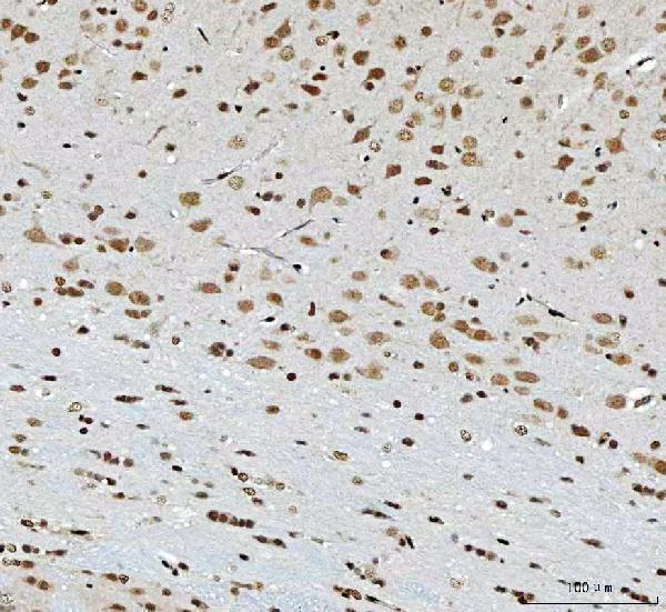 a08519 2 thap11 primary antibodies ihc testing 6