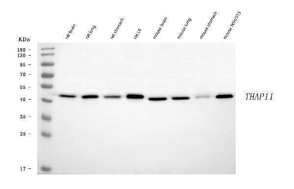  Western blot analysis of THAP11 using anti-THAP11 antibody (A08519-2)