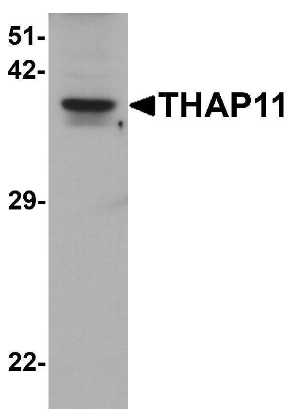 Western blot analysis of THAP11 in human brain tissue lysate with THAP11 antibody at 1 μg/ml
