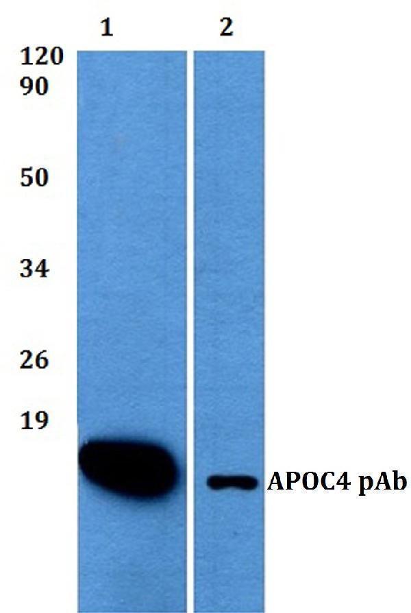 Western blot (WB) analysis of APOC4 polyclonal antibody at 1:500 dilution
Lane1:HEK293T whole cell lysate
Lane2:sp2/0 whole cell lysate
Lane3:H9C12 whole cell lysate