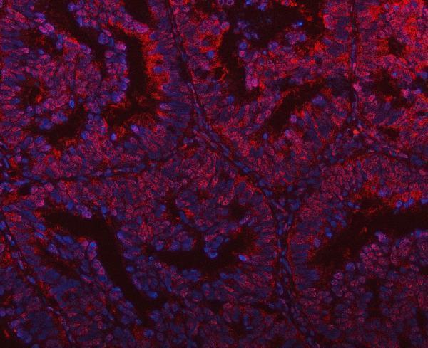 a08522 plekhg5 primary antibodies if testing 9