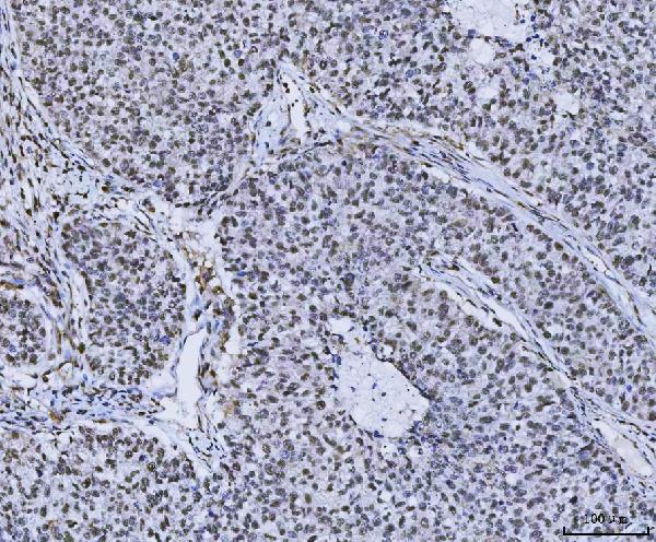 a08522 plekhg5 primary antibodies ihc testing 2