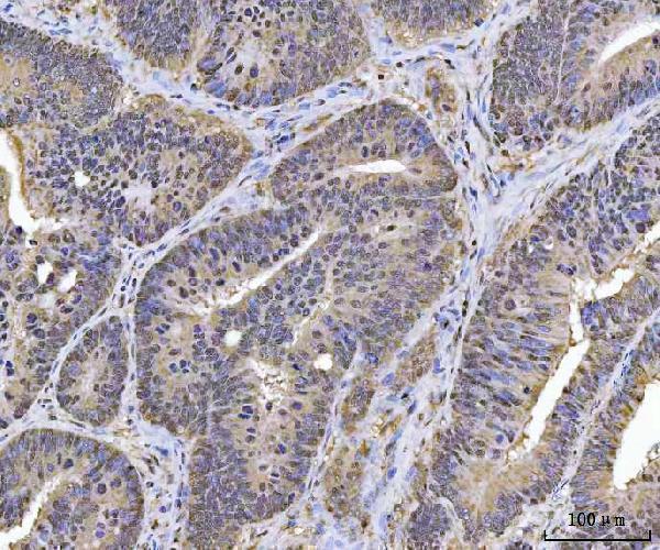 a08522 plekhg5 primary antibodies ihc testing 3