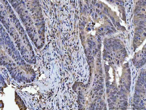 a08522 plekhg5 primary antibodies ihc testing 4