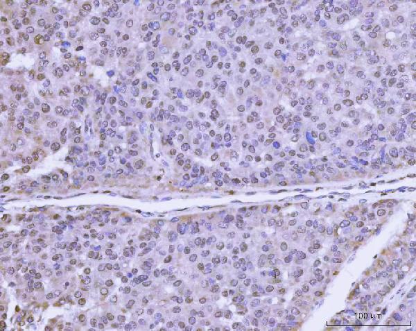 a08522 plekhg5 primary antibodies ihc testing 5