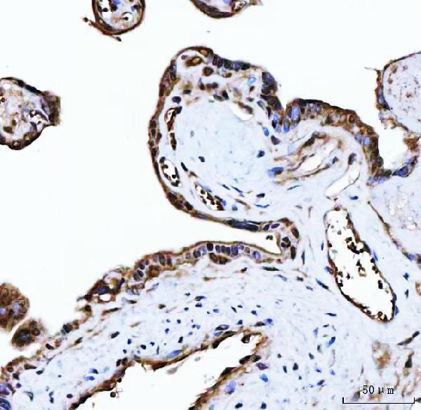 a08522 plekhg5 primary antibodies ihc testing 6